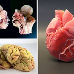 Medizinische Organmodelle 3D Drucken, PolyJet Verfahren