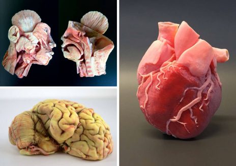 Medizinische Organmodelle 3D Drucken, PolyJet Verfahren