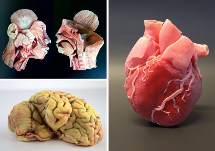Medizinische Organmodelle 3D Drucken, PolyJet Verfahren