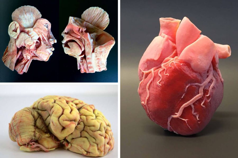 Medizinische Organmodelle 3D Drucken, PolyJet Verfahren